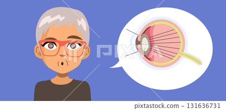 Cartoon Senior Woman With Cataracts and Eye Infographic Showing Vision Problem Vector Illustration 131636731