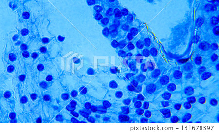 Lillium 0vary 131678397