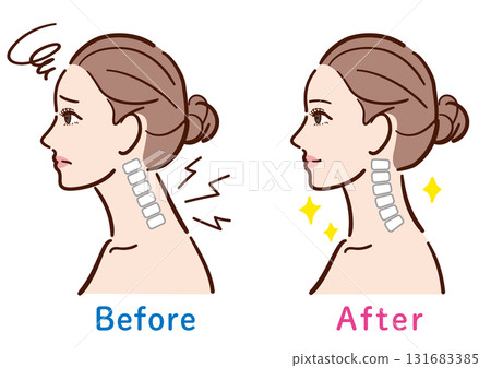Illustration of the change from a straight neck to a normal state (female profile) Illustration of the change from a straight neck to a normal state (female profile) 131683385