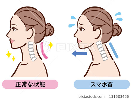 正確姿勢與智慧型手機頸部的比較圖（女性側面） 131683466