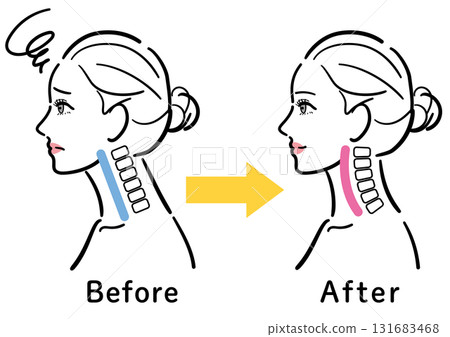 Illustration of the change from a straight neck to a normal state (female profile) 131683468