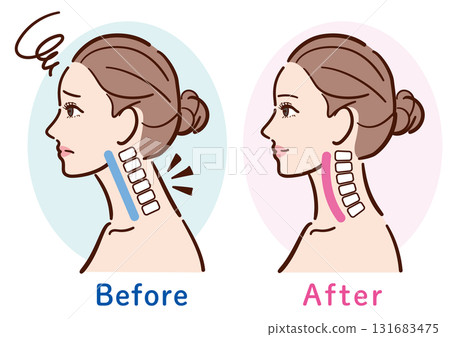 Illustration of the change from a straight neck to a normal state (female profile) 131683475