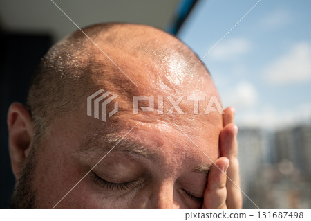 Man forehead sunstroke sweat on face, bald head. Guy suffers from heat high temperature, overheating Man forehead sunstroke sweat on face, bald head. Guy suffers from heat high temperature, overheating 131687498