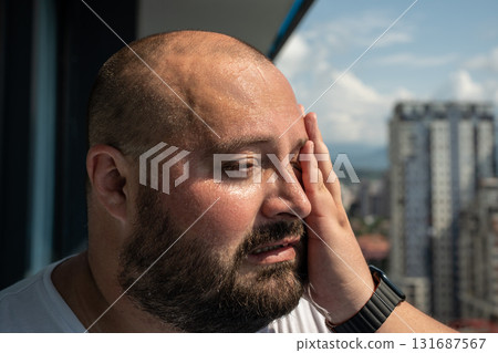 Fat man suffers dying from heat. Guy on balcony under hot summer sun sweats from high temperatures 131687567