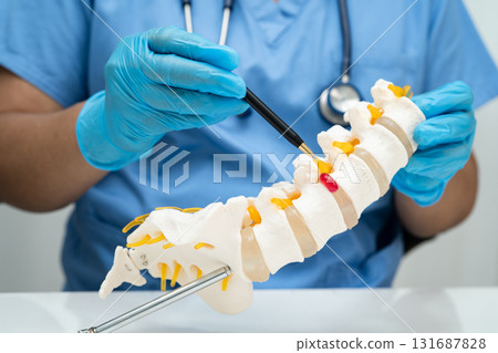 Asian doctor holding spinal nerve and bone model, Lumbar spine displaced herniated disc fragment for treatment medical in the orthopedic department. Asian doctor holding spinal nerve and bone model, Lumbar spine displaced herniated disc fragment for treatment medical in the orthopedic department. 131687828