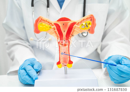 Doctor holding human uterus model for vaginal and cervix pap smear check up in the obstetrics and gynecology. Doctor holding human uterus model for vaginal and cervix pap smear check up in the obstetrics and gynecology. 131687830