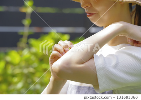 一名婦女在園藝時被昆蟲叮咬後,感覺很癢 一名婦女在園藝時被昆蟲叮咬後,感覺很癢 131693360