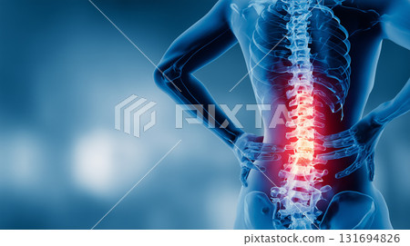 人體影像:腰痛 人體影像:腰痛 131694826