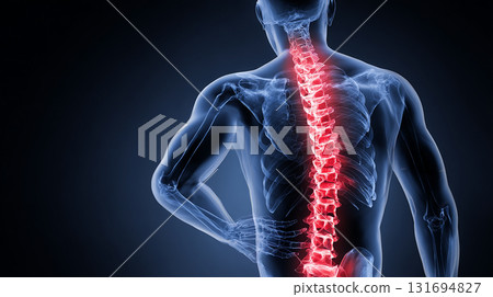 人體影像：腰痛 131694827