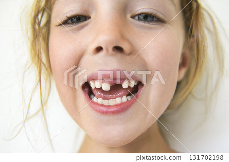 Smiling little girl missing tooth on white background Smiling little girl missing tooth on white background 131702198