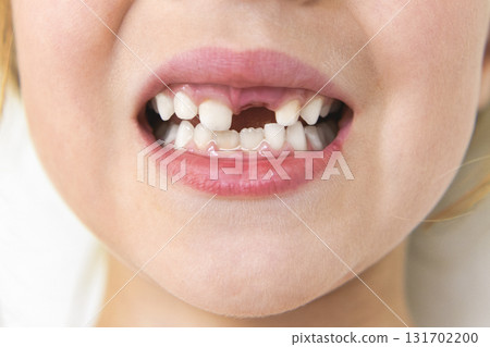 Smiling little girl missing tooth on white background Smiling little girl missing tooth on white background 131702200