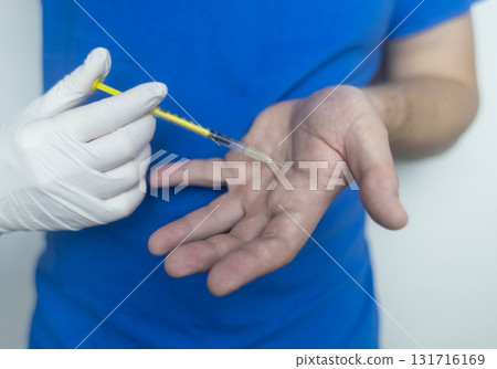 A man suffers from palmar hyperhidrosis. He wipes his sweaty palms due to excessive sweating. Treatment of hyperhidrosis with botulinum toxin injection into the hand. A man suffers from palmar hyperhidrosis. He wipes his sweaty palms due to excessive sweating. Treatment of hyperhidrosis with botulinum toxin injection into the hand. 131716169