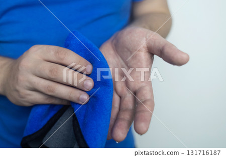 A man suffers from palmar hyperhidrosis. He wipes his sweaty palms due to excessive sweating. Treatment of hyperhidrosis with botulinum toxin injection into the hand. A man suffers from palmar hyperhidrosis. He wipes his sweaty palms due to excessive sweating. Treatment of hyperhidrosis with botulinum toxin injection into the hand. 131716187