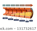 Coronary atherosclerosis timeline 131732617