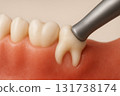 拔除智齒牙科治療 131738174