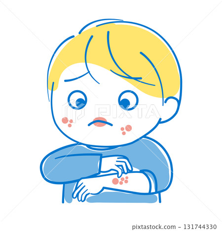 Boy with itchy skin due to allergies 131744330
