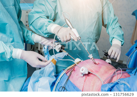 Process of gynecological surgery operation using laparoscopic equipment.  131756629