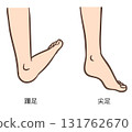 踝關節畸形、足跟畸形和馬蹄足 131762670