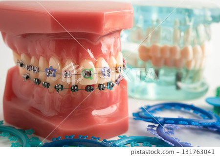 Orthodontic ligatures rings and ties, elastic rubber bands on orthodontic braces, model for dentist studying about dentistry. 131763041