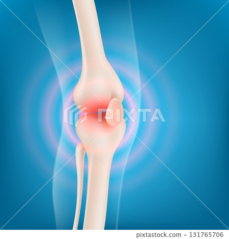 Anatomy knee joint of a human leg with pain Anatomy knee joint of a human leg with pain 131765706