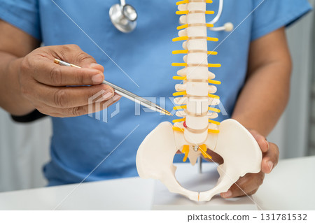 Asian doctor holding spinal nerve and bone model, Lumbar spine displaced herniated disc fragment for treatment medical in the orthopedic department. 131781532