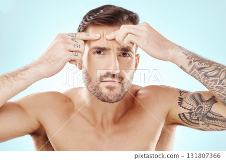Face, portrait and skin of man with acne or pimple problem with dermatology for self care studio. Frustrated or angry person with hands to press spot for skincare facial wellness on blue background Face, portrait and skin of man with acne or pimple problem with dermatology for self care studio. Frustrated or angry person with hands to press spot for skincare facial wellness on blue background 131807366