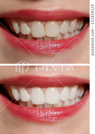 [Vertical photo] Whitening 131839129