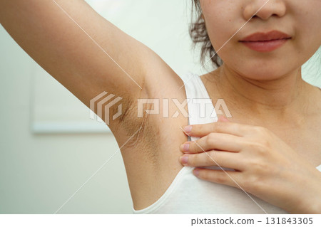 Asian woman have problem black armpit beauty skin care. Asian woman have problem black armpit beauty skin care. 131843305