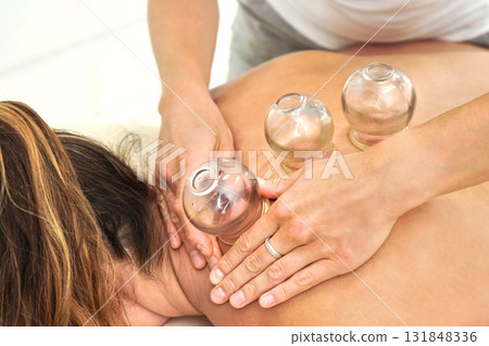 Young female physiotherapist applying glass suction banks on back of her patient, during cupping therapy, closeup detail Young female physiotherapist applying glass suction banks on back of her patient, during cupping therapy, closeup detail 131848336