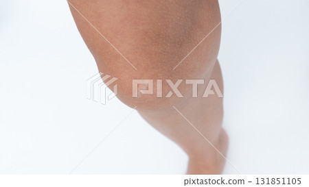 Close-up of a knee showcasing a prominent scar, highlighting skin texture and natural beauty in a minimalistic setting with copy space 131851105