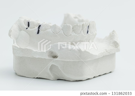 Lower dental plaster model with occlusion marks Lower dental plaster model with occlusion marks 131862033