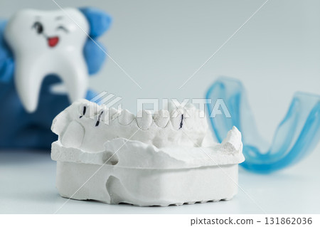 Plaster dental model with occlusion markings in focus, with blue mouthguard and winking cartoon tooth held by gloved hand in background. 131862036