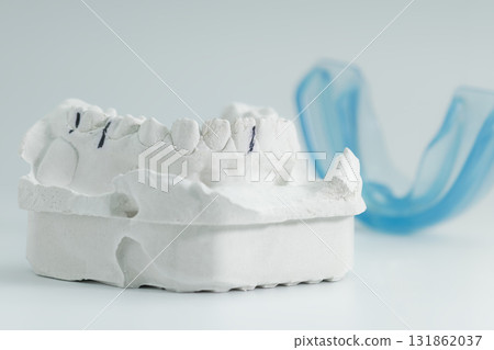 Close-up of dental plaster model with mouthguard Close-up of dental plaster model with mouthguard 131862037