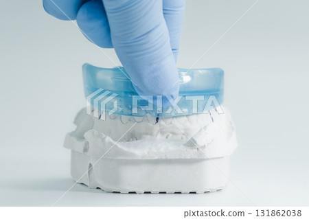 Dental mouthguard being placed on plaster model 131862038