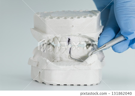 Dental plaster bite model examined with tool Dental plaster bite model examined with tool 131862040