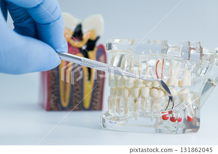 dental root canal model being examined with a dental tool, used for education, training, or patient explanation. 131862045