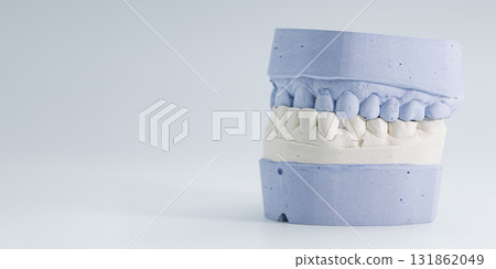 Orthodontic plaster model of human teeth alignment 131862049