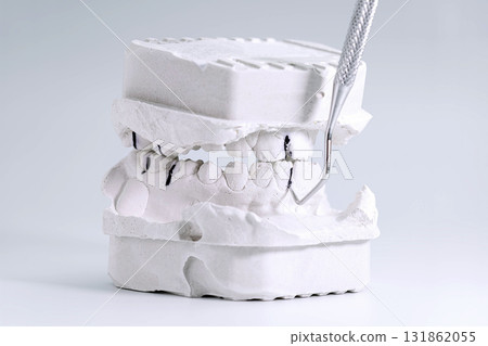 Dental plaster model with marked occlusion points Dental plaster model with marked occlusion points 131862055