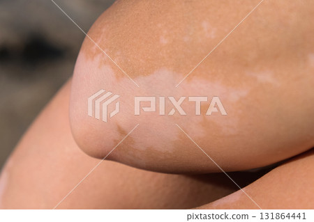 Skin Skin 131864441
