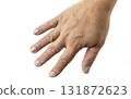 Hand with finger splints and bandages is shown against white background, indicating injury or support. skin tone is light brown, and bandages are beige, providing neutral contrast 131872623
