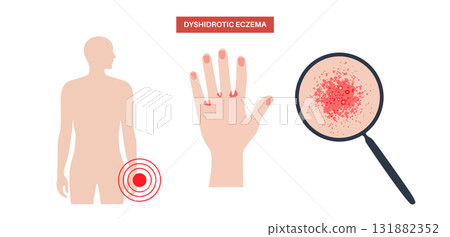 Dermatitis skin disease Dermatitis skin disease 131882352