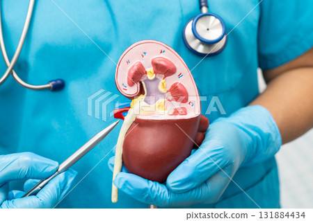 Kidney disease, Chronic kidney disease ckd, Doctor hold model to study and treat in hospital. Kidney disease, Chronic kidney disease ckd, Doctor hold model to study and treat in hospital. 131884434
