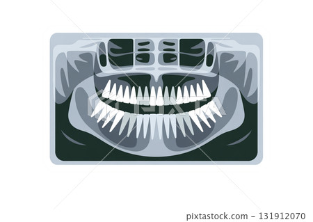 Dental X-ray image illustration (panoramic radiograph) 131912070