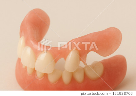 Non-clasp dentures 131928703