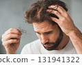 Worried man holding fallen hair in hands 131941322