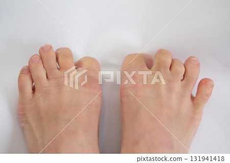 40多歲女人雙腿 40多歲女人雙腿 131941418