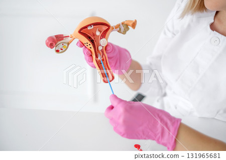 A model of the female reproductive organ. Taking a smear for analysis from the cervical canal. Diagnosis of diseases in gynecology A model of the female reproductive organ. Taking a smear for analysis from the cervical canal. Diagnosis of diseases in gynecology 131965681