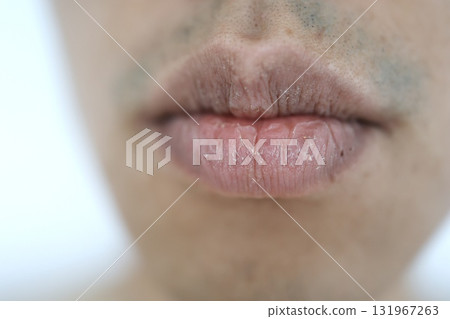 男人乾燥嘴唇的特寫。 男人乾燥嘴唇的特寫。 131967263