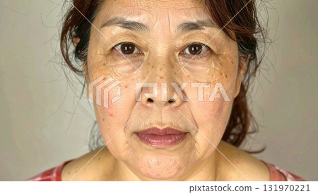 Senior women and skin concerns 131970221