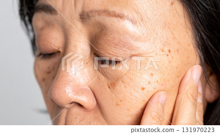 Senior women and skin concerns 131970223